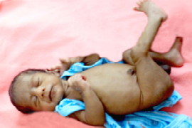 Rehabilitate poor child