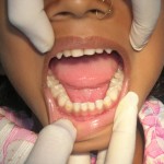 Community Dental Project